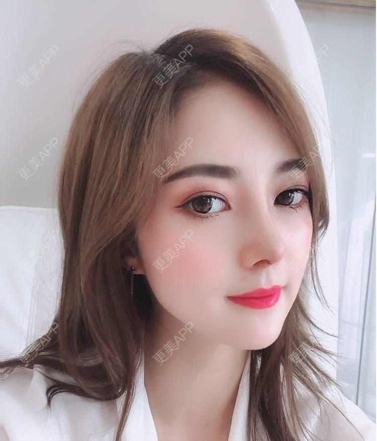 薄荷港粤的隆鼻日记