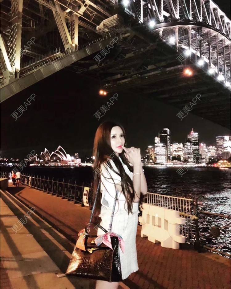 更美 - A🍒sisibaby🍒私人号的经验 | 眼部多项 | 视频日记 | 玻尿酸眉弓 | 深圳