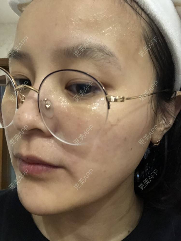 更美 - 一白遮三丑丑丑的舒敏之星经验 | 上海 | 舒敏之星