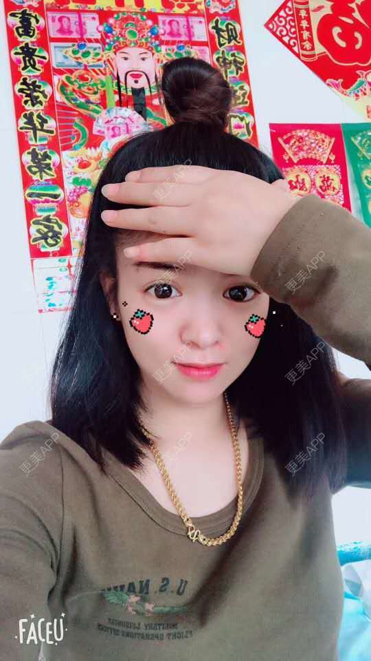 更美 - 平平淡淡的小生活的经验 | 瘦脸除皱 | 除皱瘦脸 | 注射缩鼻头 | 贵阳