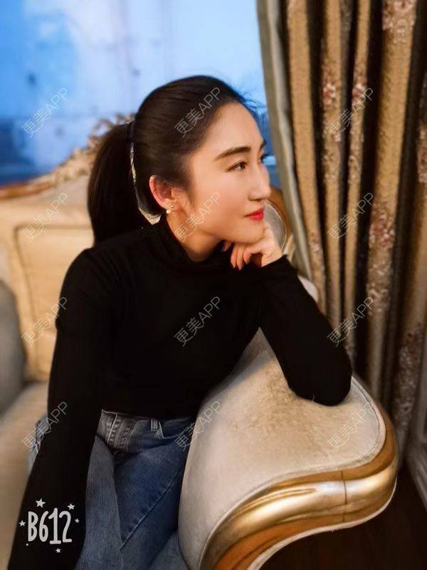 更美 - 更美用户lt1IEyirnq的玻尿酸苹果肌经验 | 长沙 | 玻尿酸苹果肌