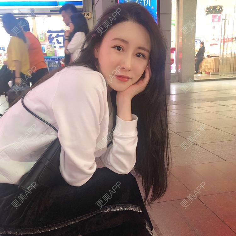 更美 - 兰质慧心的自体脂肪丰苹果肌经验 | 上海 | 视频日记 | 自体脂肪丰面颊 | 自体脂肪丰苹果肌 | 自体脂肪垫下巴