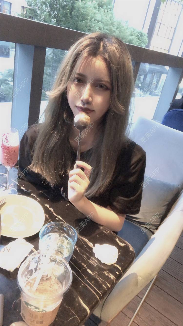 更美 - 可爱的猪猪呀的自体脂肪丰苹果肌经验 | 自体脂肪丰苹果肌 | 自体脂肪全面部填充 | 自体脂肪丰太阳穴 | 杭州 | 自体脂肪丰额头 | 视频日记 | 自体脂肪垫下巴