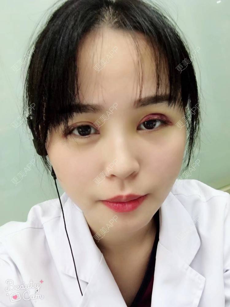 更美 - 更美用户aPZ5J5UfoG的全切双眼皮经验 | 全切双眼皮 | 深圳