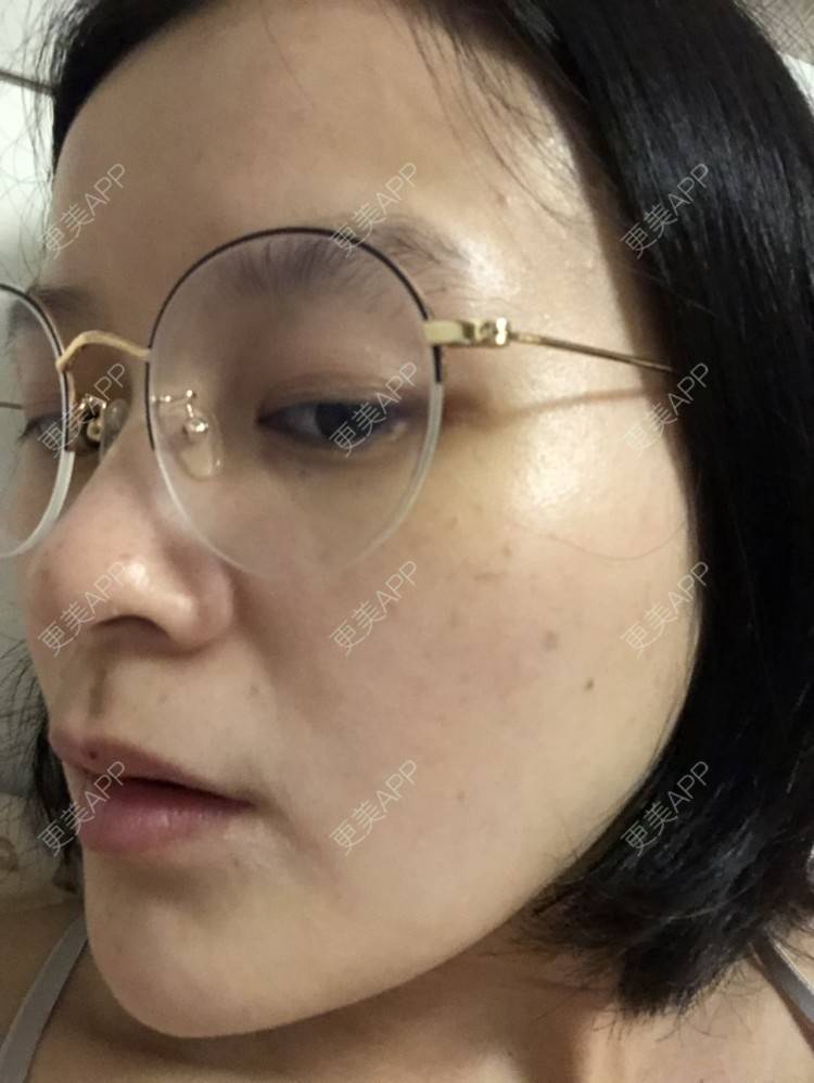 更美 - 一白遮三丑丑丑的舒敏之星经验 | 上海 | 舒敏之星