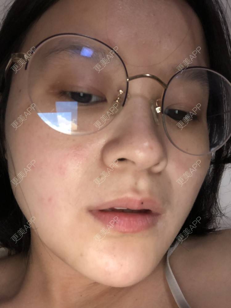 更美 - 一白遮三丑丑丑的舒敏之星经验 | 上海 | 舒敏之星