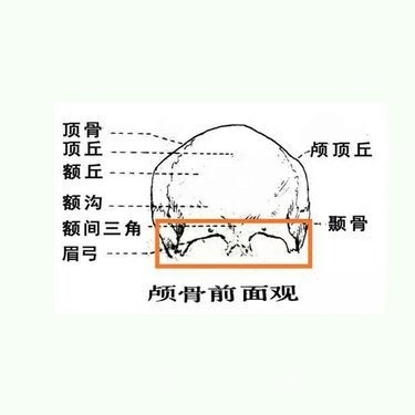 自体脂肪垫眉弓