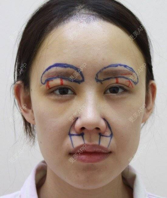 更美用户arfjega7ne的膨体垫眉弓日记