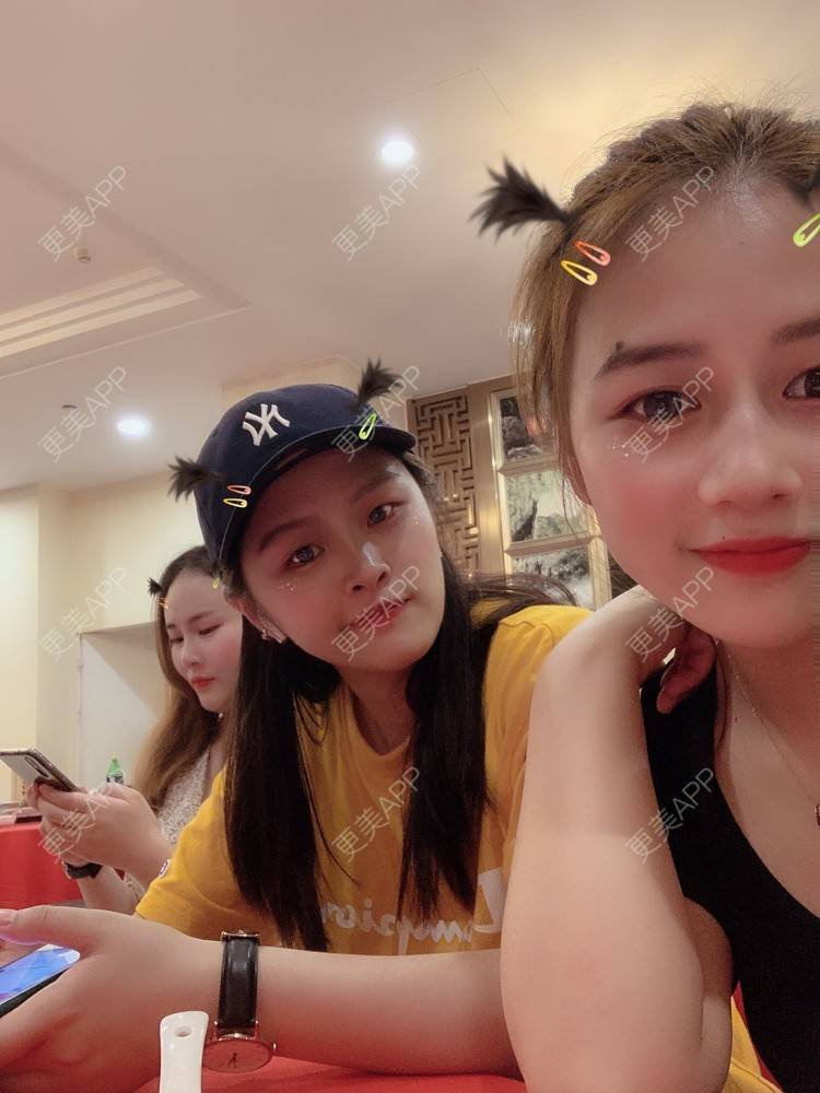更美 - 蒋小五～的树脂补牙经验 | 重庆 | 树脂补牙