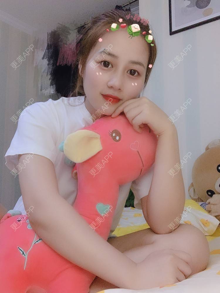 更美 - 蒋小五～的树脂补牙经验 | 重庆 | 树脂补牙