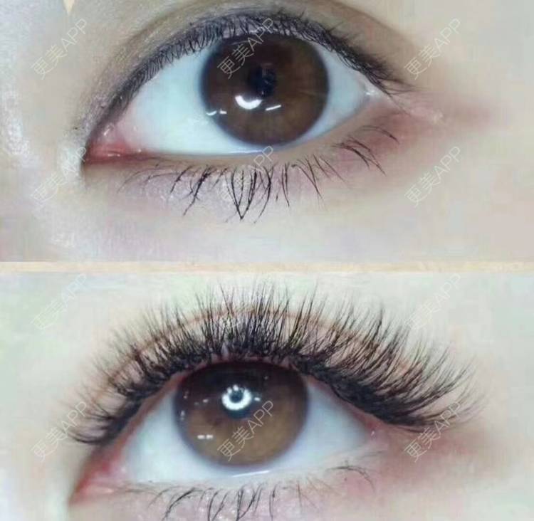 更美 - 姑娘要坚强的植睫毛经验 | 植睫毛