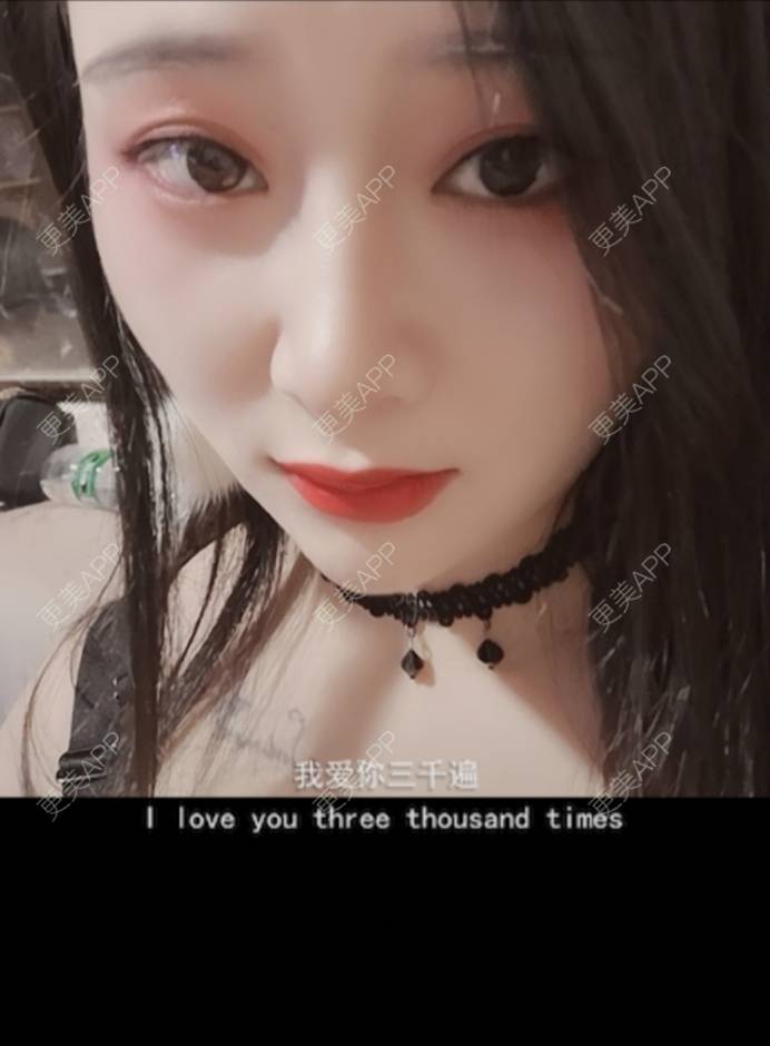 更美 - 更美用户J1mgNZN5cT的鼻部多项经验 | 鼻部多项 | 成都