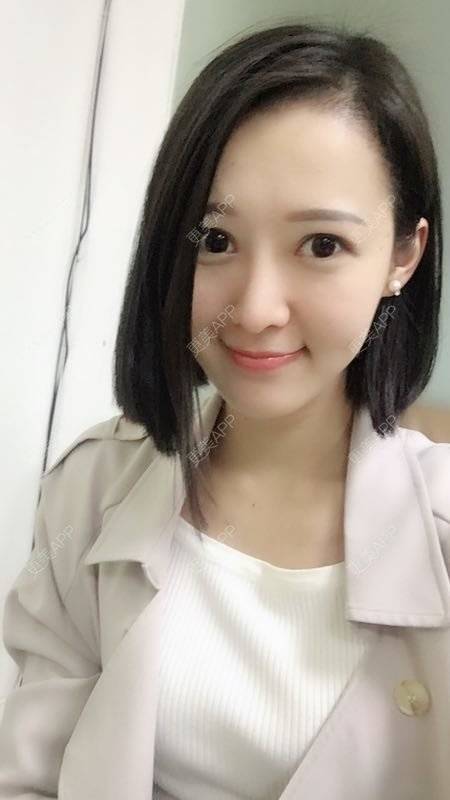 更美 - 小小苗子的隆鼻经验 | 鼻部综合 | 鼻部膨体假体取出 | 隆鼻 | 广州