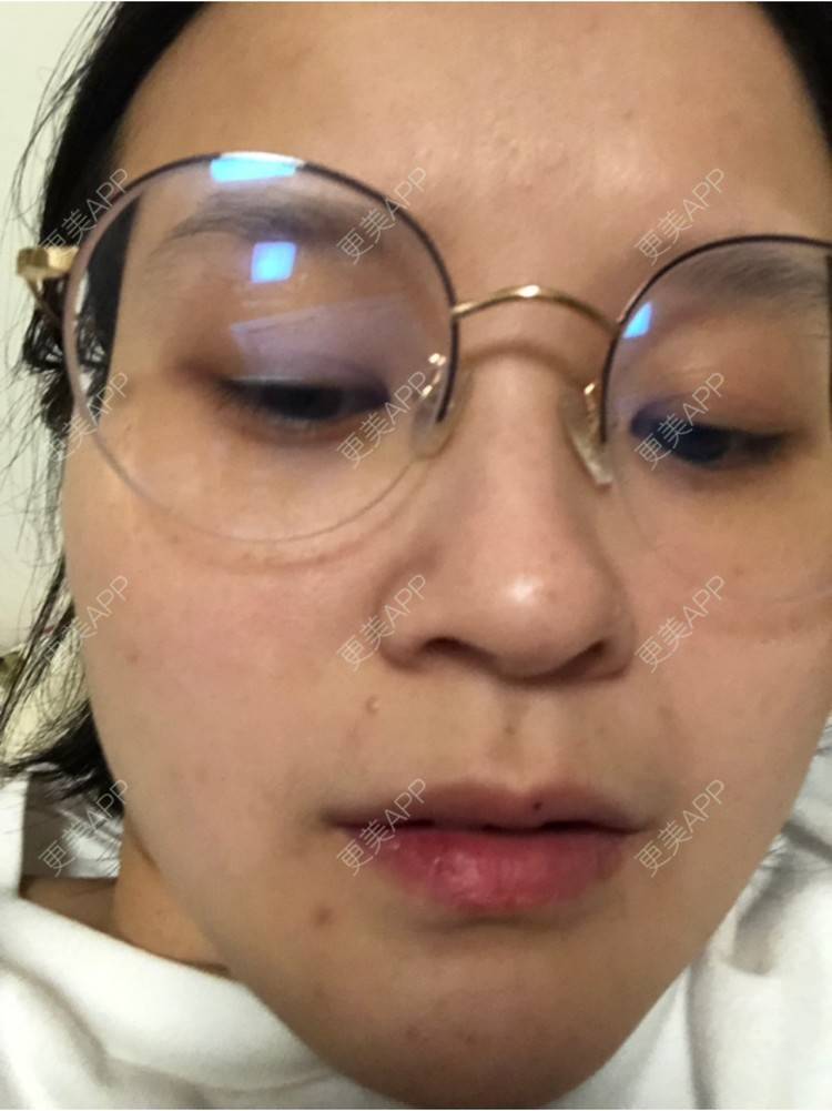 更美 - 一白遮三丑丑丑的舒敏之星经验 | 上海 | 舒敏之星