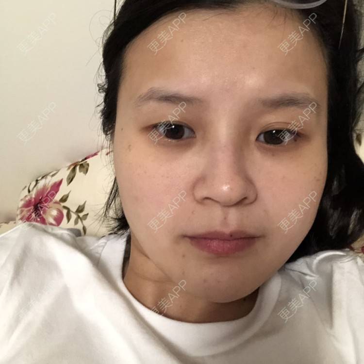 更美 - 一白遮三丑丑丑的舒敏之星经验 | 上海 | 舒敏之星