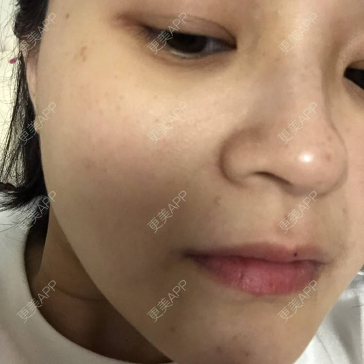 更美 - 一白遮三丑丑丑的舒敏之星经验 | 上海 | 舒敏之星