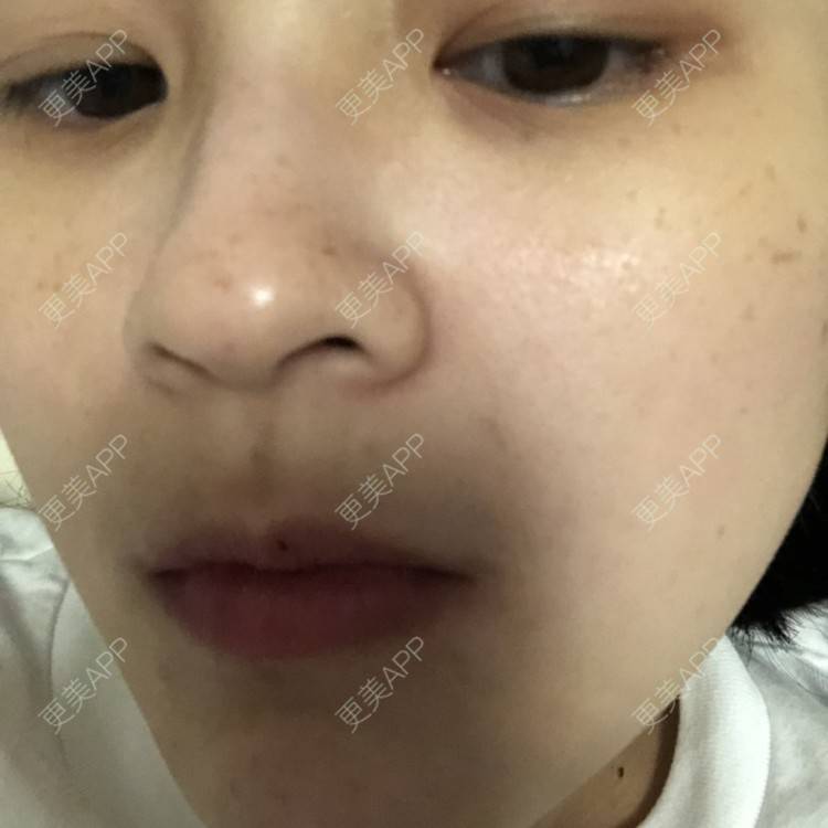 更美 - 一白遮三丑丑丑的舒敏之星经验 | 上海 | 舒敏之星