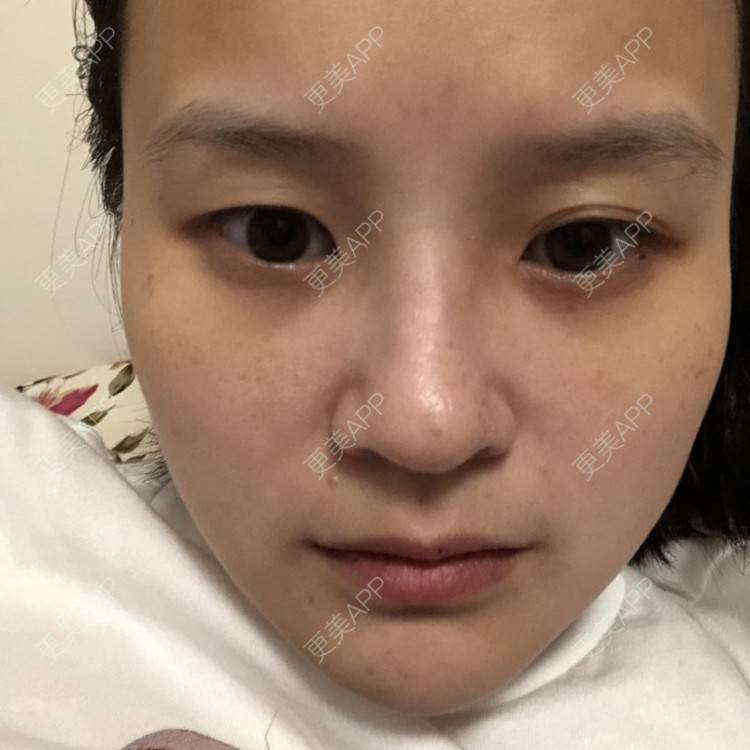 更美 - 一白遮三丑丑丑的舒敏之星经验 | 上海 | 舒敏之星