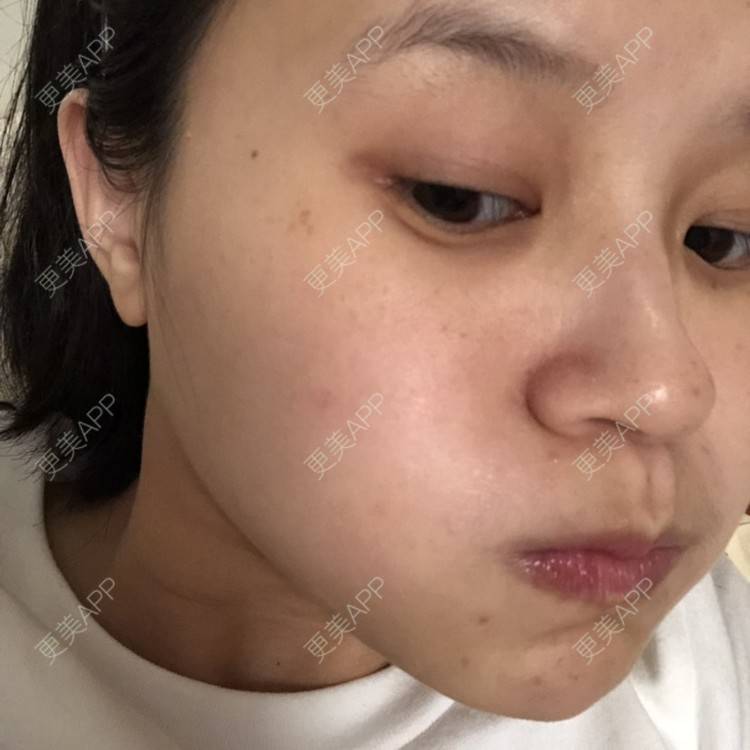 更美 - 一白遮三丑丑丑的舒敏之星经验 | 上海 | 舒敏之星
