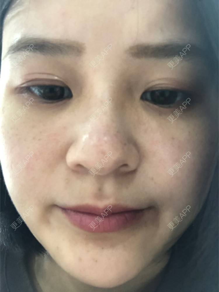 更美 - 一白遮三丑丑丑的舒敏之星经验 | 上海 | 舒敏之星