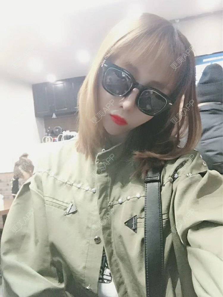 更美 - 更美用户I4G4fnb0pM的吸脂瘦脸经验 | 天津 | 吸脂瘦脸