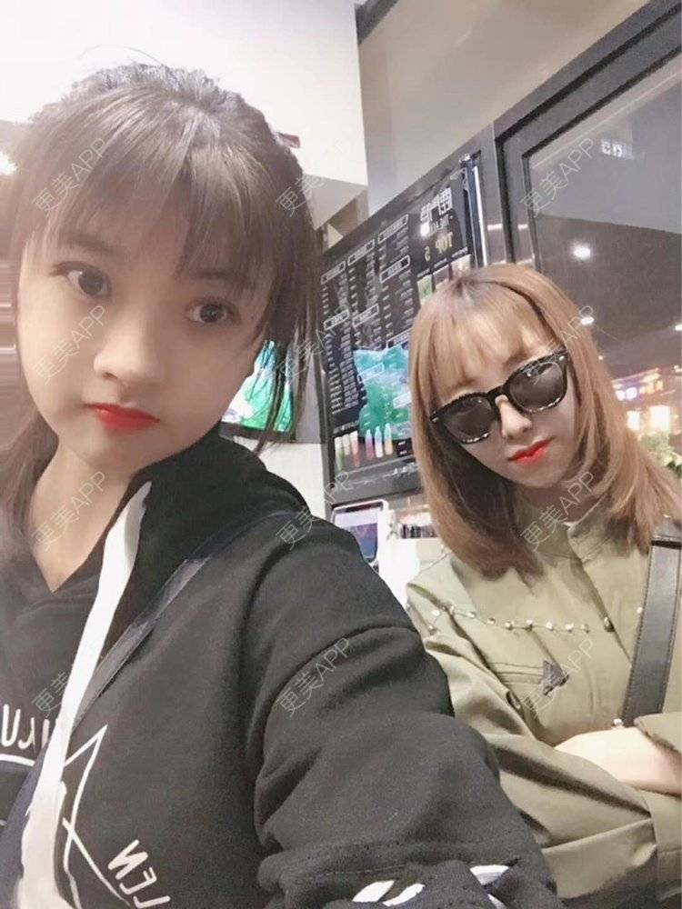 更美 - 更美用户I4G4fnb0pM的吸脂瘦脸经验 | 天津 | 吸脂瘦脸