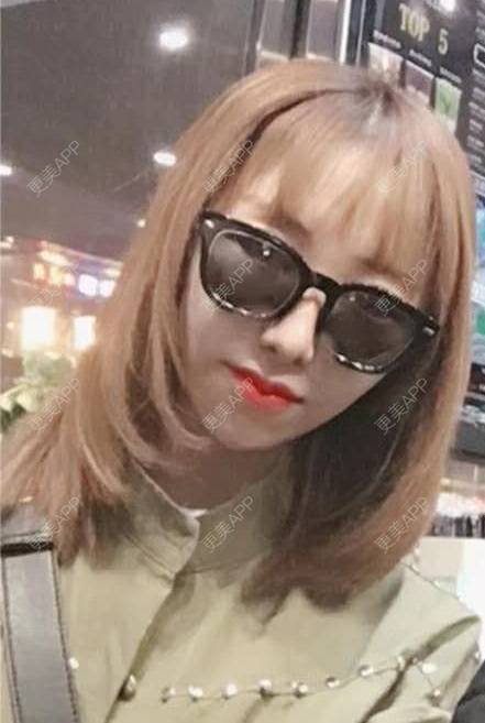 更美 - 更美用户I4G4fnb0pM的吸脂瘦脸经验 | 天津 | 吸脂瘦脸