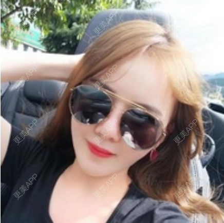 更美 - 更美用户ypzNojyDXF的胶原蛋白改善法令纹经验 | 上海 | 胶原蛋白改善法令纹
