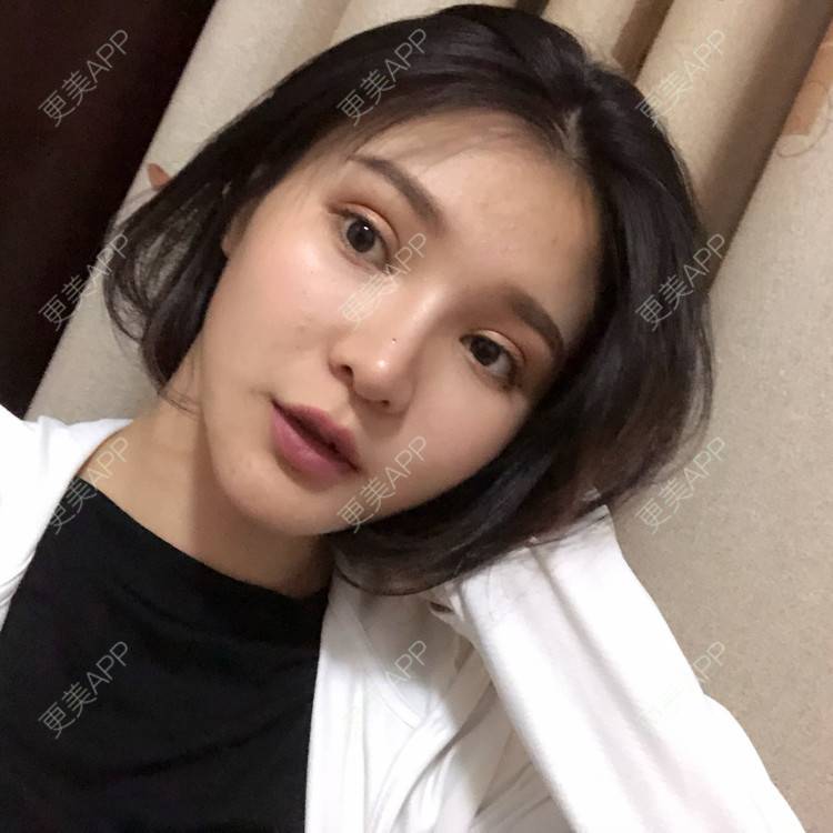 更美 - 更美用户0GOaTxhYaU的鼻部多项经验 | 温州 | 鼻部多项