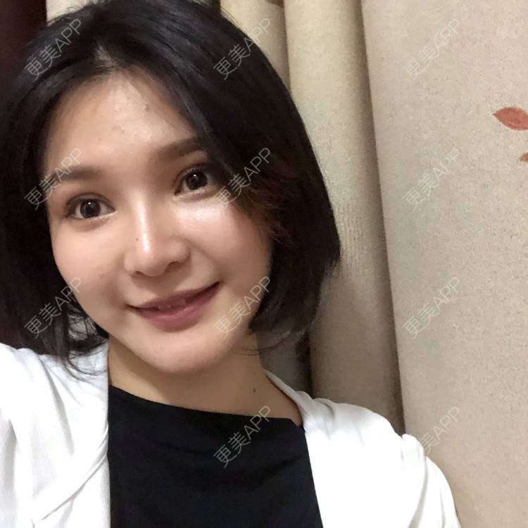 更美 - 更美用户0GOaTxhYaU的鼻部多项经验 | 温州 | 鼻部多项