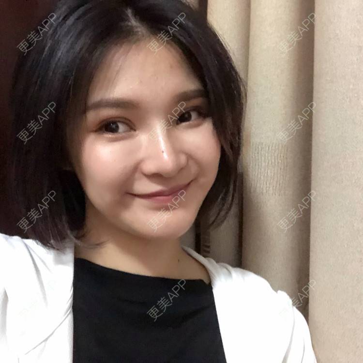 更美 - 更美用户0GOaTxhYaU的鼻部多项经验 | 温州 | 鼻部多项