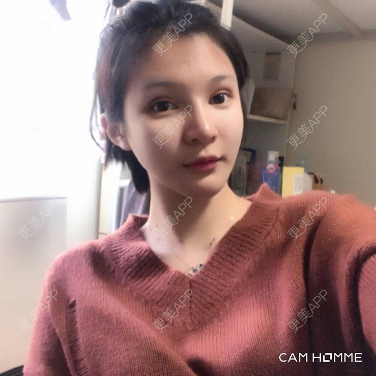 更美 - 更美用户0GOaTxhYaU的鼻部多项经验 | 温州 | 鼻部多项