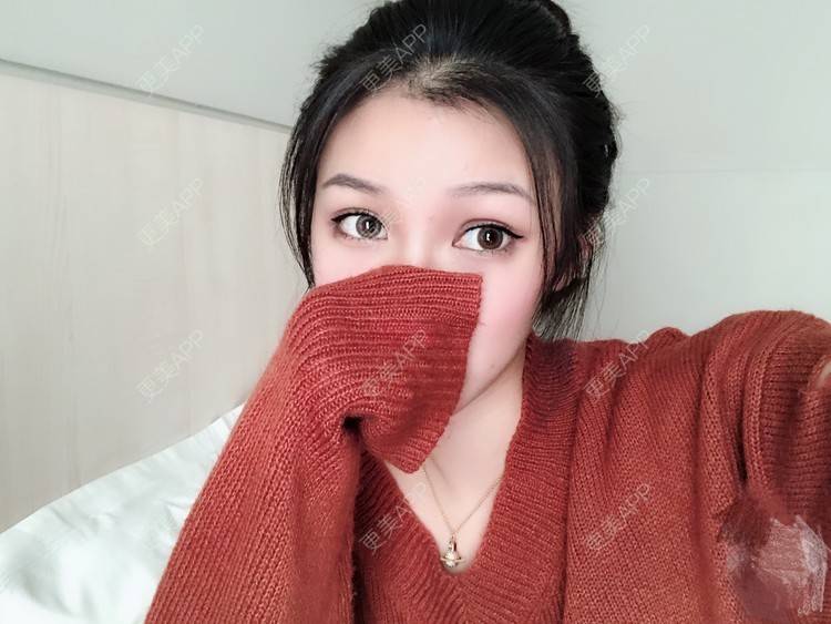 更美 - 更美用户0GOaTxhYaU的鼻部多项经验 | 温州 | 鼻部多项
