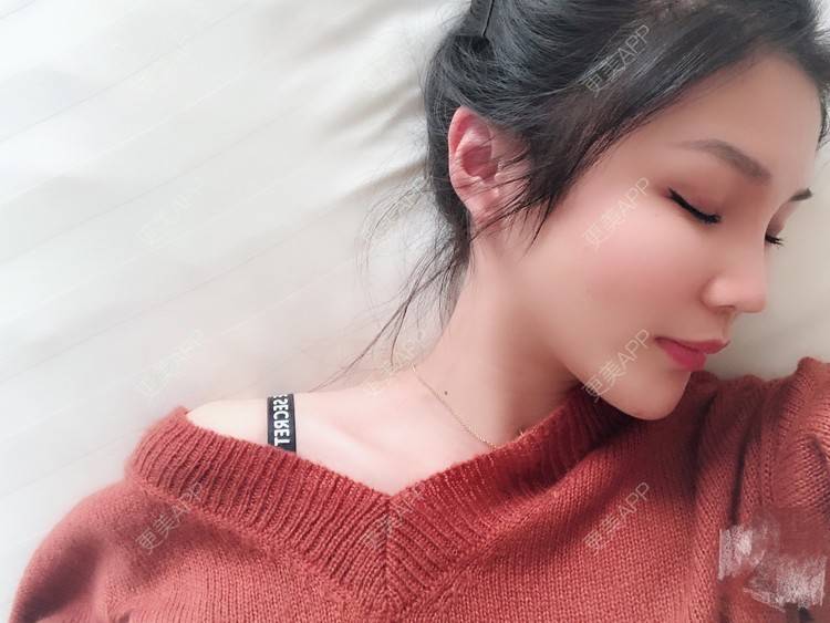 更美 - 更美用户0GOaTxhYaU的鼻部多项经验 | 温州 | 鼻部多项