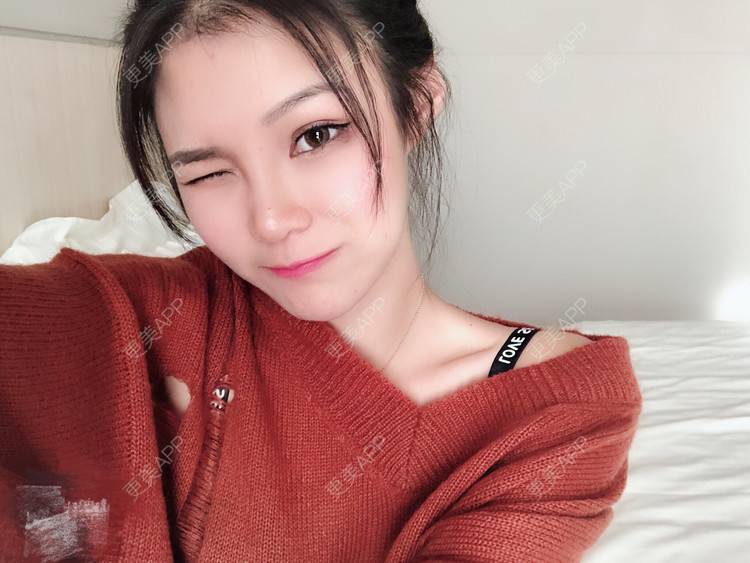 更美 - 更美用户0GOaTxhYaU的鼻部多项经验 | 温州 | 鼻部多项