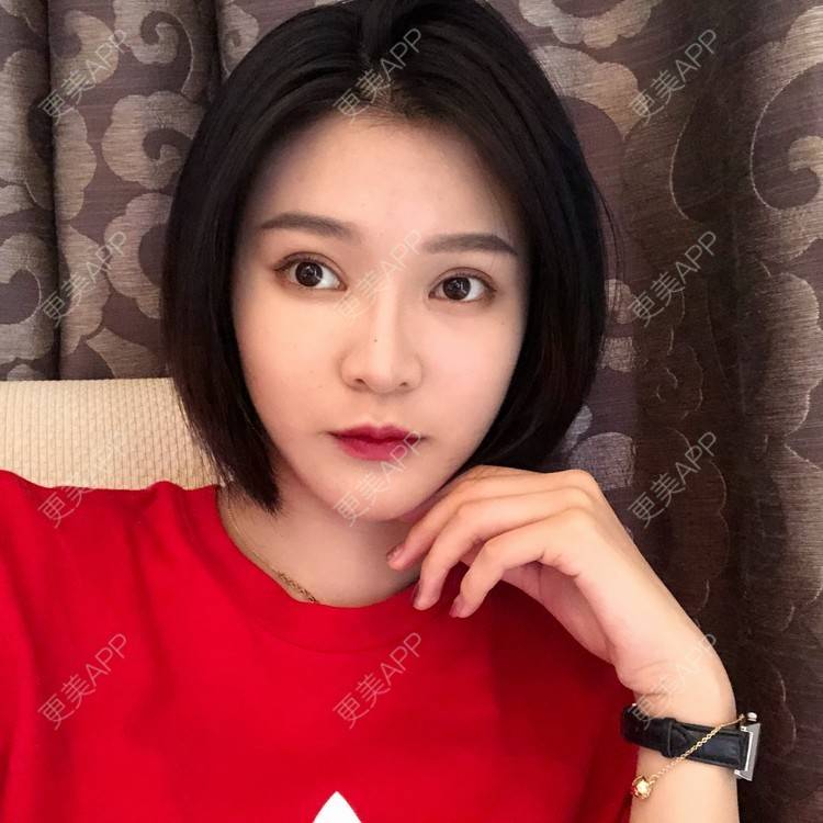 更美 - 更美用户0GOaTxhYaU的鼻部多项经验 | 温州 | 鼻部多项