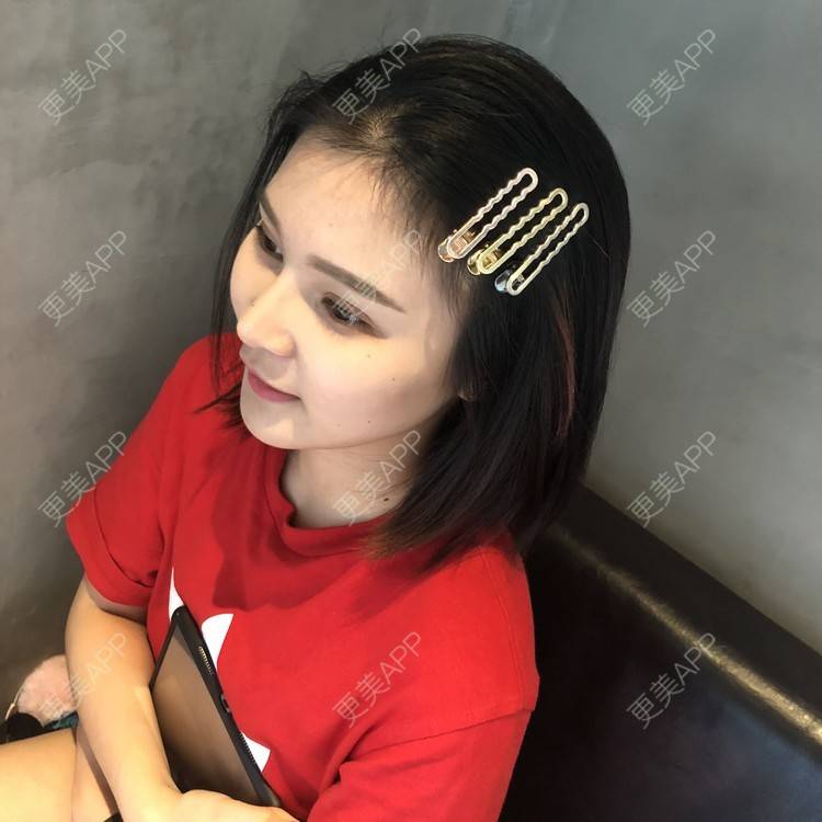 更美 - 更美用户0GOaTxhYaU的鼻部多项经验 | 温州 | 鼻部多项