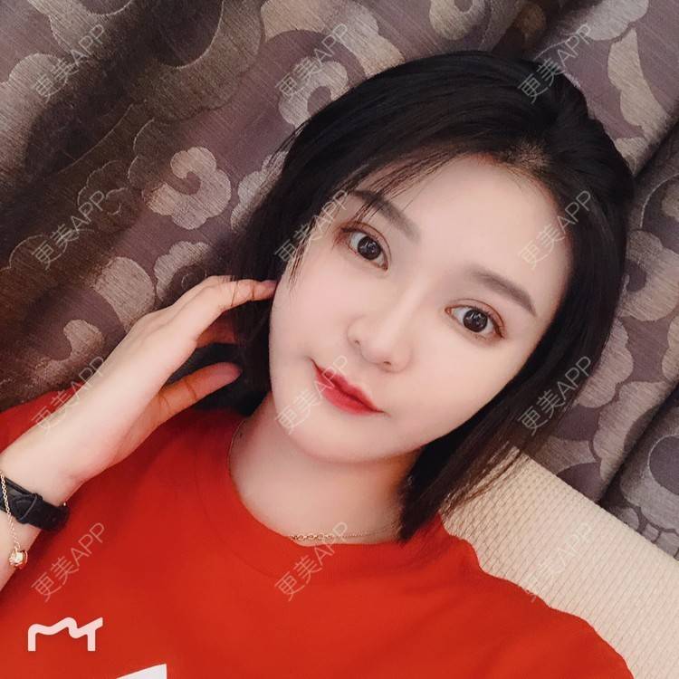 更美 - 更美用户0GOaTxhYaU的鼻部多项经验 | 温州 | 鼻部多项
