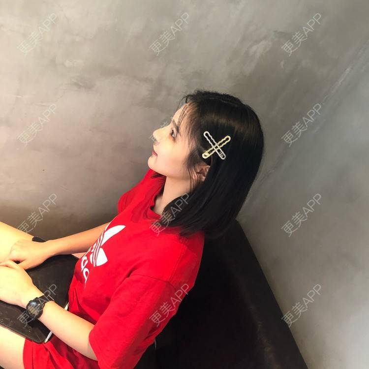 更美 - 更美用户0GOaTxhYaU的鼻部多项经验 | 温州 | 鼻部多项