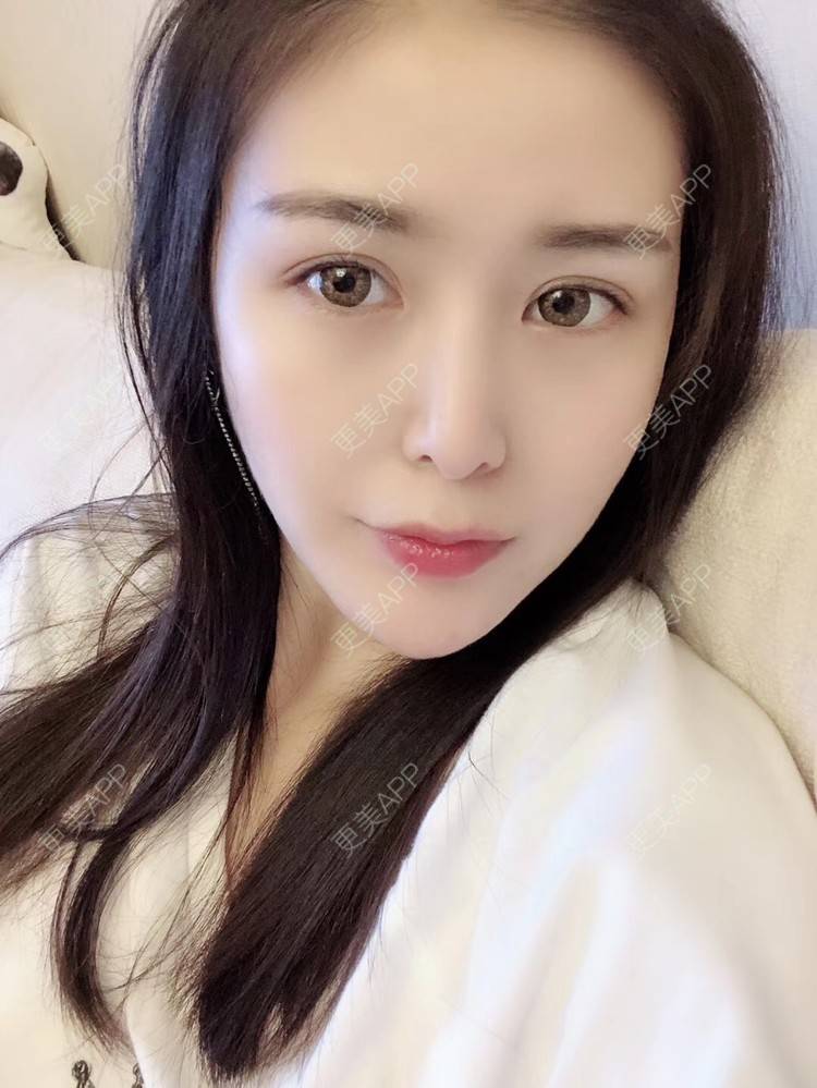 更美 - 梁家小晴晴的胶原蛋白淡化黑眼圈经验 | 胶原蛋白淡化黑眼圈 | 北京
