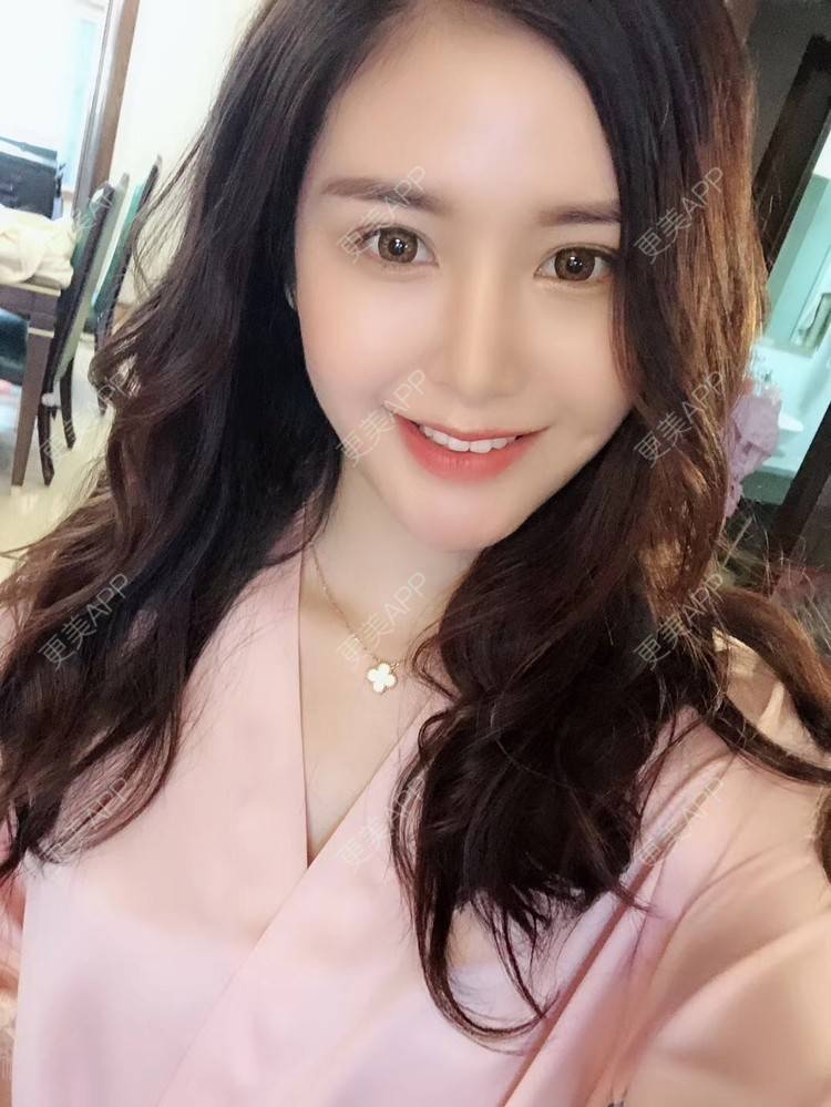 更美 - 梁家小晴晴的胶原蛋白淡化黑眼圈经验 | 胶原蛋白淡化黑眼圈 | 北京