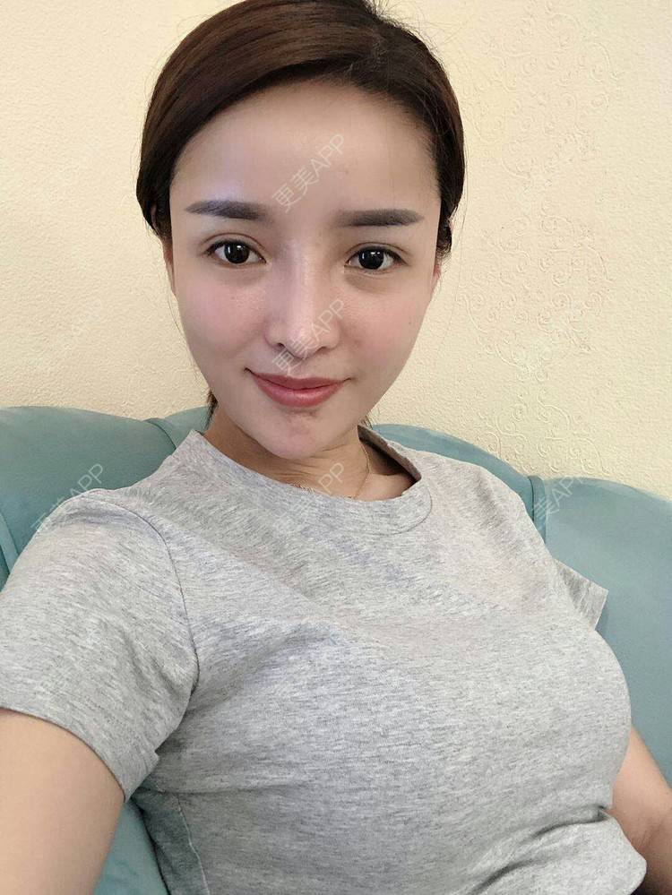 变少女的静静的假体隆胸日记