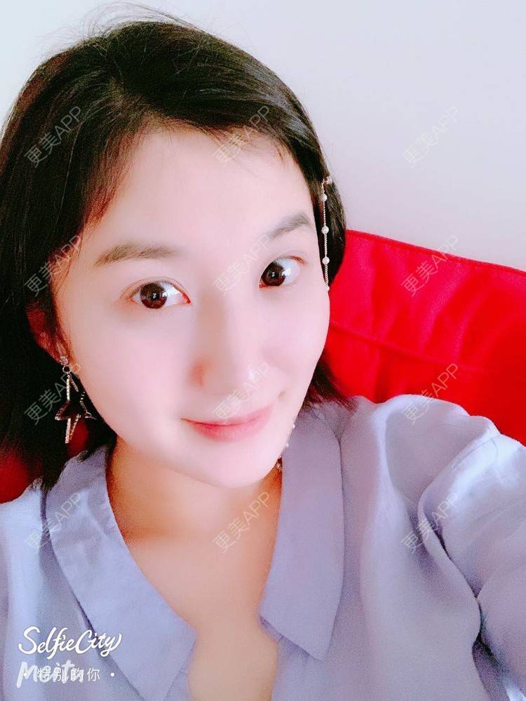 更美 - 更美用户v4fdzYgBRM的胶原蛋白淡化黑眼圈经验 | 胶原蛋白淡化黑眼圈 | 北京