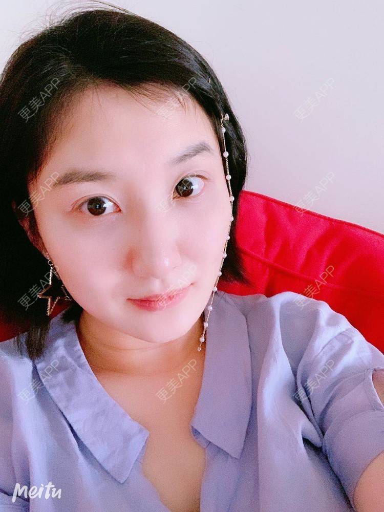 更美 - 更美用户v4fdzYgBRM的胶原蛋白淡化黑眼圈经验 | 胶原蛋白淡化黑眼圈 | 北京
