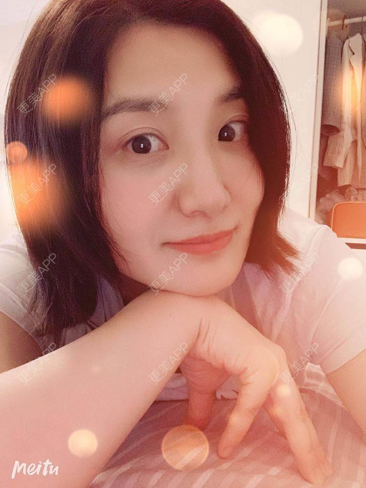 更美 - 更美用户v4fdzYgBRM的胶原蛋白淡化黑眼圈经验 | 胶原蛋白淡化黑眼圈 | 北京