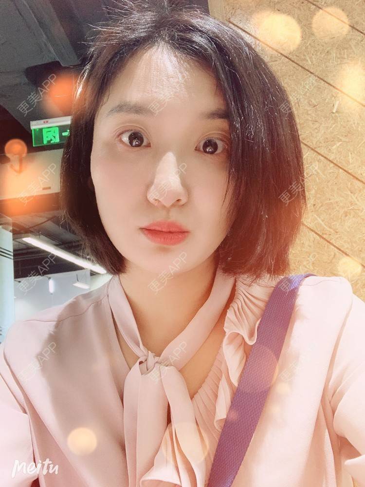 更美 - 更美用户v4fdzYgBRM的胶原蛋白淡化黑眼圈经验 | 胶原蛋白淡化黑眼圈 | 北京