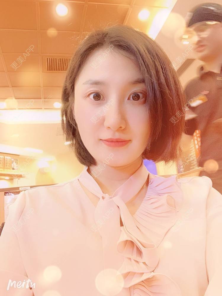 更美 - 更美用户v4fdzYgBRM的胶原蛋白淡化黑眼圈经验 | 胶原蛋白淡化黑眼圈 | 北京