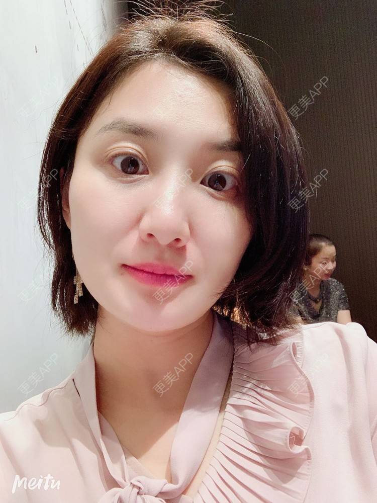 更美 - 更美用户v4fdzYgBRM的胶原蛋白淡化黑眼圈经验 | 胶原蛋白淡化黑眼圈 | 北京