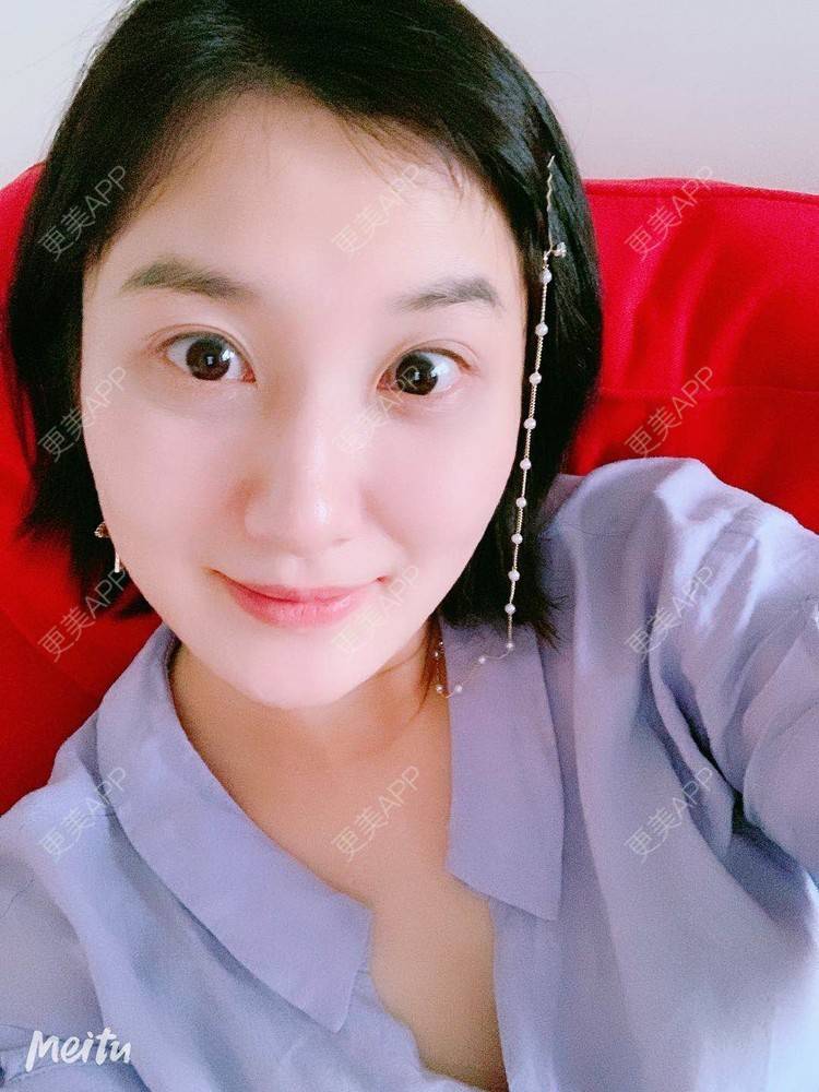 更美 - 更美用户v4fdzYgBRM的胶原蛋白淡化黑眼圈经验 | 胶原蛋白淡化黑眼圈 | 北京