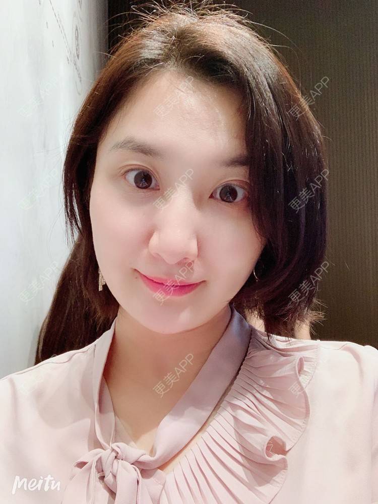 更美 - 更美用户v4fdzYgBRM的胶原蛋白淡化黑眼圈经验 | 胶原蛋白淡化黑眼圈 | 北京